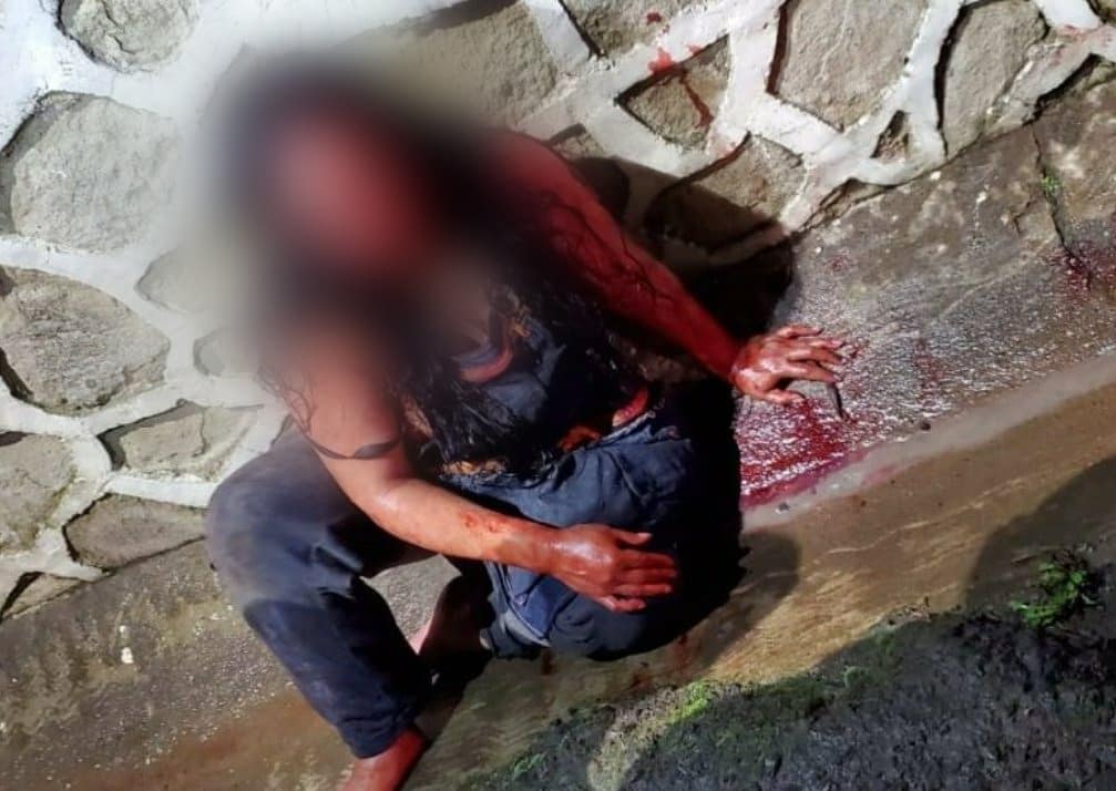 Mujer camina con la cabeza de su pareja en Amecameca #regionmx